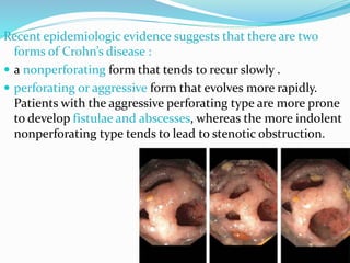 Recent epidemiologic evidence suggests that there are two
forms of Crohn’s disease :
 a nonperforating form that tends to recur slowly .
 perforating or aggressive form that evolves more rapidly.
Patients with the aggressive perforating type are more prone
to develop fistulae and abscesses, whereas the more indolent
nonperforating type tends to lead to stenotic obstruction.
 