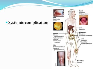  Systemic complication
 