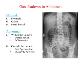 Gastro intestinal tract (abdomen) radiology | PPTX