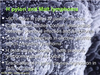 H pylori and Malt lymphoma
 ~90% have H pylori in gastric mucosa~90% have H pylori in gastric mucosa
 Case control studies confirm relationshipCase control studies confirm relationship
between previous infection and lymphomabetween previous infection and lymphoma
 Clonal B cell detection in chronic gastritisClonal B cell detection in chronic gastritis
which precedes lymphomawhich precedes lymphoma
 H pylori strain specific T cells promoteH pylori strain specific T cells promote
lymphoma growth in culturelymphoma growth in culture
 Eradication of H pylori causes regression inEradication of H pylori causes regression in
75% of caces75% of caces
 