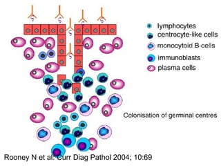 Rooney N et al: Curr Diag Pathol 2004; 10:69
 