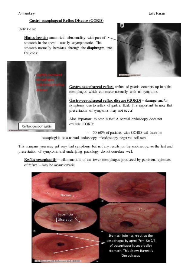 Gastrooesophageal reflux (GORD)