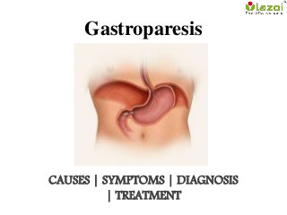 Gastroparesis
CAUSES | SYMPTOMS | DIAGNOSIS
| TREATMENT
 