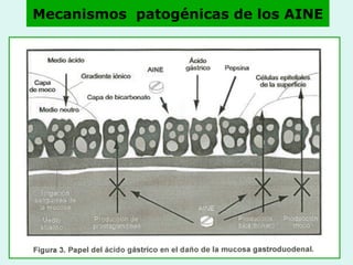 Mecanismos  patogénicas de los AINE 