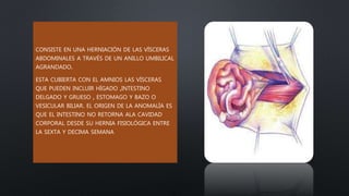 CONSISTE EN UNA HERNIACIÓN DE LAS VÍSCERAS
ABDOMINALES A TRAVÉS DE UN ANILLO UMBILICAL
AGRANDADO.
ESTA CUBIERTA CON EL AMNIOS LAS VÍSCERAS
QUE PUEDEN INCLUIR HÍGADO ,INTESTINO
DELGADO Y GRUESO , ESTOMAGO Y BAZO O
VESICULAR BILIAR. EL ORIGEN DE LA ANOMALÍA ES
QUE EL INTESTINO NO RETORNA ALA CAVIDAD
CORPORAL DESDE SU HERNIA FISIOLÓGICA ENTRE
LA SEXTA Y DECIMA SEMANA
 