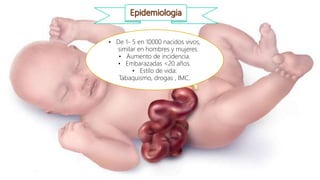 • De 1- 5 en 10000 nacidos vivos,
similar en hombres y mujeres.
• Aumento de incidencia.
• Embarazadas <20 años.
• Estilo de vida:
Tabaquismo, drogas , IMC.
 