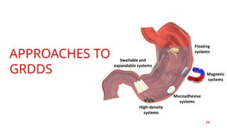Grdds Article GASTRO RETENTIVE DRUG DELIVERY SYSTEMS . | PPTX
