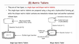 Comprehensive Overview of Gastro Retentive Drug Delivery Systems and Formulation Approaches
