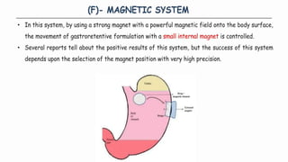 Comprehensive Overview of Gastro Retentive Drug Delivery Systems and Formulation Approaches