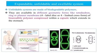 Comprehensive Overview of Gastro Retentive Drug Delivery Systems and Formulation Approaches