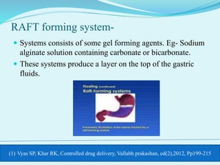 Formulation Approaches For Gastro Retentive Drug Delivery | PPTX