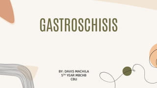 GASTROSCHISIS
BY: DAVIS MACHILA
5TH YEAR MBCHB
CBU
 