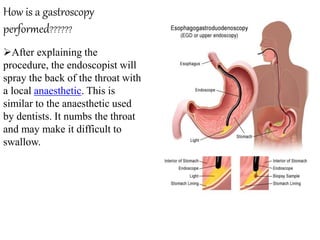 How is a gastroscopy
performed??????
After explaining the
procedure, the endoscopist will
spray the back of the throat with
a local anaesthetic. This is
similar to the anaesthetic used
by dentists. It numbs the throat
and may make it difficult to
swallow.
 