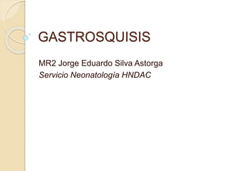 GASTROSQUISIS
MR2 Jorge Eduardo Silva Astorga
Servicio Neonatología HNDAC
 