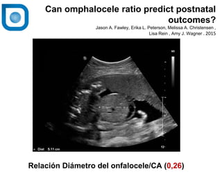 1
Can omphalocele ratio predict postnatal
outcomes?
Jason A. Fawley, Erika L. Peterson, Melissa A. Christensen ,
Lisa Rein , Amy J. Wagner . 2015
Normal
Relación Diámetro del onfalocele/CA (0,26)
 