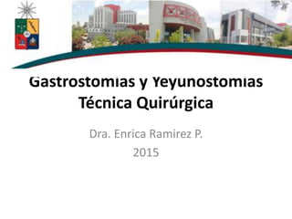 Gastrostomías y Yeyunostomías
Técnica Quirúrgica
Dra. Enrica Ramirez P.
2015
 