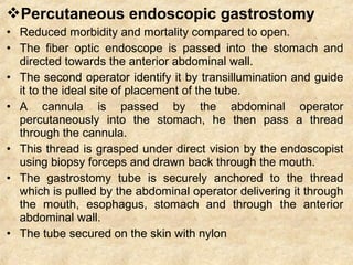 Percutaneous endoscopic gastrostomy
• Reduced morbidity and mortality compared to open.
• The fiber optic endoscope is passed into the stomach and
directed towards the anterior abdominal wall.
• The second operator identify it by transillumination and guide
it to the ideal site of placement of the tube.
• A cannula is passed by the abdominal operator
percutaneously into the stomach, he then pass a thread
through the cannula.
• This thread is grasped under direct vision by the endoscopist
using biopsy forceps and drawn back through the mouth.
• The gastrostomy tube is securely anchored to the thread
which is pulled by the abdominal operator delivering it through
the mouth, esophagus, stomach and through the anterior
abdominal wall.
• The tube secured on the skin with nylon
 