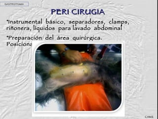 PERI CIRUGIA Instrumental  básico,  separadores,  clamps, riñonera, líquidos  para lavado  abdominal Preparación  del  área  quirúrgica. Posicionamiento  GASTROTOMIA CAMZ 