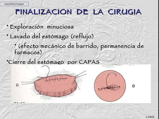 FINALIZACION  DE  LA  CIRUGIA Exploración  minuciosa Lavado del estómago (reflujo) (efecto mecánico de barrido, permanencia de farmacos) Cierre del estómago  por CAPAS GASTROTOMIA CAMZ 