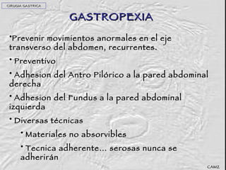 GASTROPEXIA Prevenir movimientos anormales en el eje transverso del abdomen, recurrentes. Preventivo Adhesion del Antro Pilórico a la pared abdominal derecha Adhesion del Fundus a la pared abdominal izquierda Diversas técnicas Materiales no absorvibles Tecnica adherente… serosas nunca se adherirán CAMZ CIRUGIA GASTRICA 