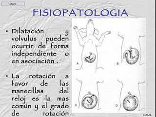 FISIOPATOLOGIA Dilatación y volvulus pueden ocurrir de forma independiente o en asociación . La rotación a favor de las manecillas del reloj es la mas común y el grado de rotación puede ser entre 90 y 270 grados.  CAMZ SDVG 