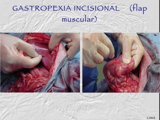 GASTROPEXIA INCISIONAL  (flap muscular) CAMZ 