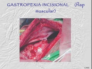 GASTROPEXIA INCISIONAL  (flap muscular) CAMZ 