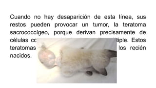 Cuando no hay desaparición de esta línea, sus
restos pueden provocar un tumor, la teratoma
sacrococcígeo, porque derivan precisamente de
células con potencial de desarrollo múltiple. Estos
teratomas son los mas comunes en los recién
nacidos.
 
