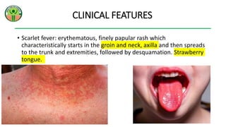 GASv - Nam pham.pptx Streptococcus Pharyngitis | PPTX