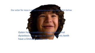 Our actor for nova is gaten mazzaroazzo more about him below
Gaten has a condition called cleidocranial
dysostosis this means his bones and his teeth
have a limited growth rate.
 
