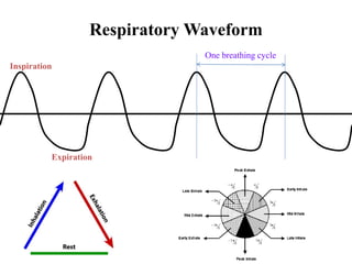 Respiratory Waveform
Expiration
Inspiration
One breathing cycle
 
