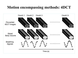 Motion encompassing methods: 4DCT
 