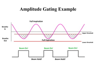 Breathe
Out
Breathe
In
Amplitude Gating Example
Beam On!
Beam Hold! Beam Hold!
Beam On! Beam On!
Upper threshold
Lower threshold
Full Expiration
Full Inspiration
 