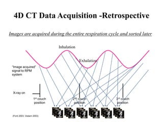 4D CT Data Acquisition -Retrospective
Images are acquired during the entire respiration cycle and sorted later
X-ray on
Exhalation
Inhalation
1st couch
position
2nd couch
position
3rd couch
position
“Image acquired”
signal to RPM
system
(Ford 2003, Vedam 2003)
 