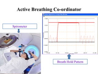 Active Breathing Co-ordinator
Spirometer
Breath Hold Pattern
 