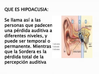 Existen 3 tipos de hipoacusia:

 Hipoacusia Conductiva


 Hipoacusia Neurosensorial


 Hipoacusia Mixta.
 