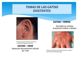 http://www.pnte.cfnavarra.es/creena/0
01auditivos/imagenes/petite3.gif
GATISO – HNIR
Hipoacusia Neurosensorial inducida
por ruido
GATISO – DERMA
Dermatitis de contacto
ocupacional irritativa y alérgica
http://www.medwave.cl/medios/Diciembre_2006/Con
gresos/HCUCH/LatexFigura5.jpg
TEMAS DE LAS GATISO
EXISTENTES
 