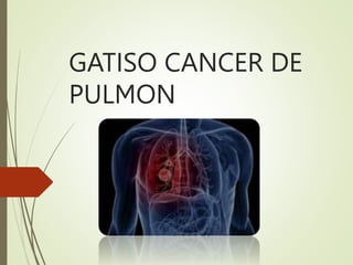 GATISO CANCER DE
PULMON
 