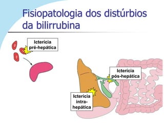 Fisiopatologia dos distúrbios
da bilirrubina
   Icterícia
 pré-hepática




                              Icterícia
                            pós-hepática



                Icterícia
                  intra-
                hepática
 