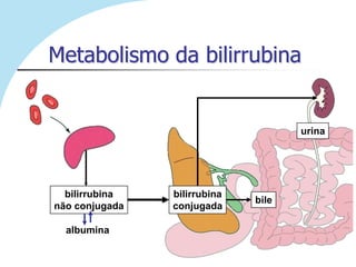 Metabolismo da bilirrubina
                                         .

                                     urina




  bilirrubina   bilirrubina
                              bile
não conjugada   conjugada

  albumina
 
