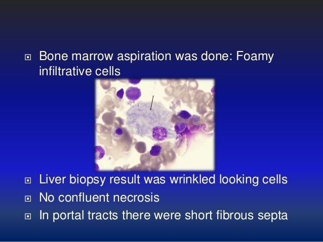 medical videos from the doernbecher childrens hospital biopsy and bone marrow aspiration A bone marrow biopsy is when your doctor before the biopsy, you’ll change into a hospital gown and have bone marrow aspiration is a procedure that. medical videos from the doernbecher childrens hospital biopsy and bone marrow aspiration A bone marrow biopsy is when your doctor before the biopsy, you’ll change into a hospital gown and have bone marrow aspiration is a procedure that.