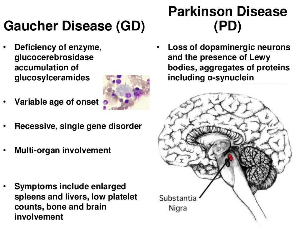 Gaucher disease past present future