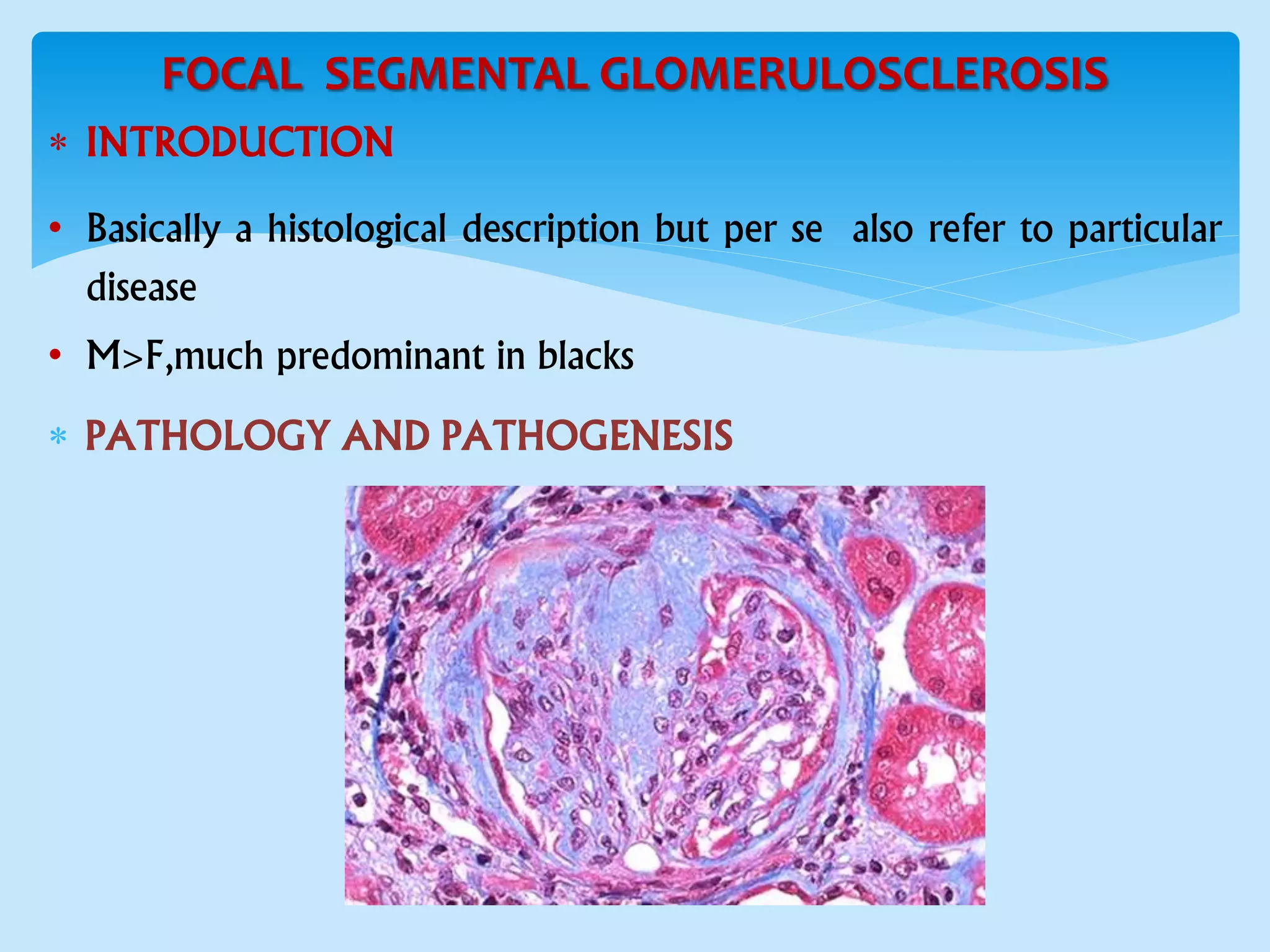 FOCAL SEGMENTAL GLOMERULOSCLEROSIS
 INTRODUCTION
• Basically a histological description but per se also refer to particular
disease
• M>F,much predominant in blacks
 PATHOLOGY AND PATHOGENESIS
 