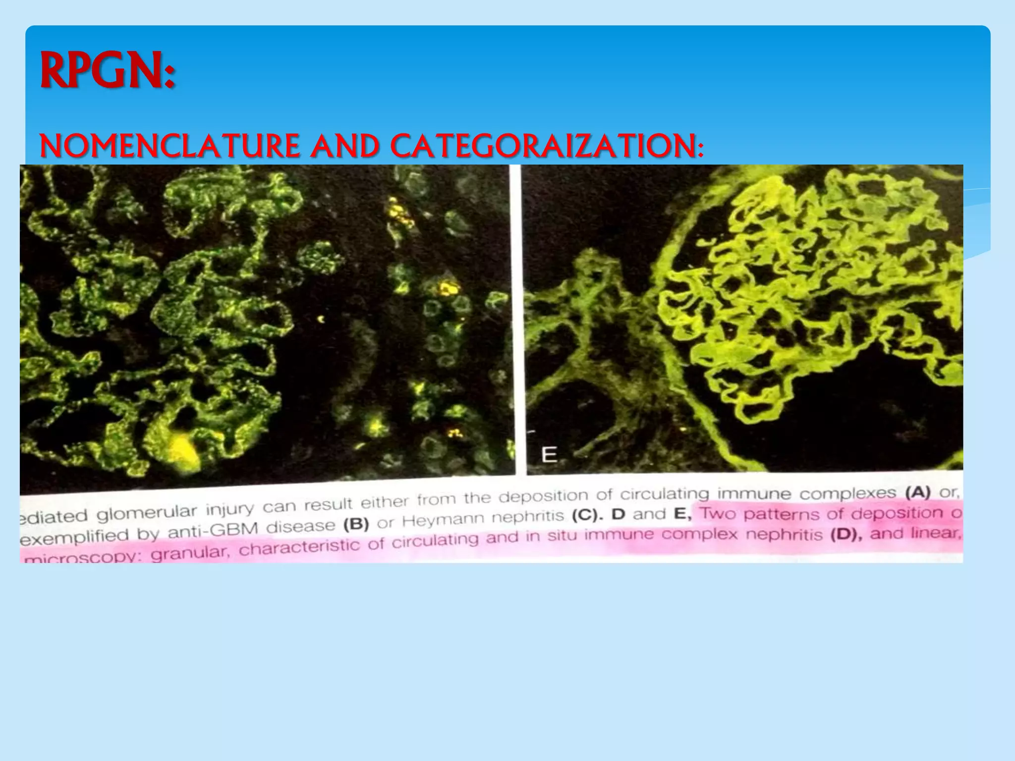 RPGN:
NOMENCLATURE AND CATEGORAIZATION:
 