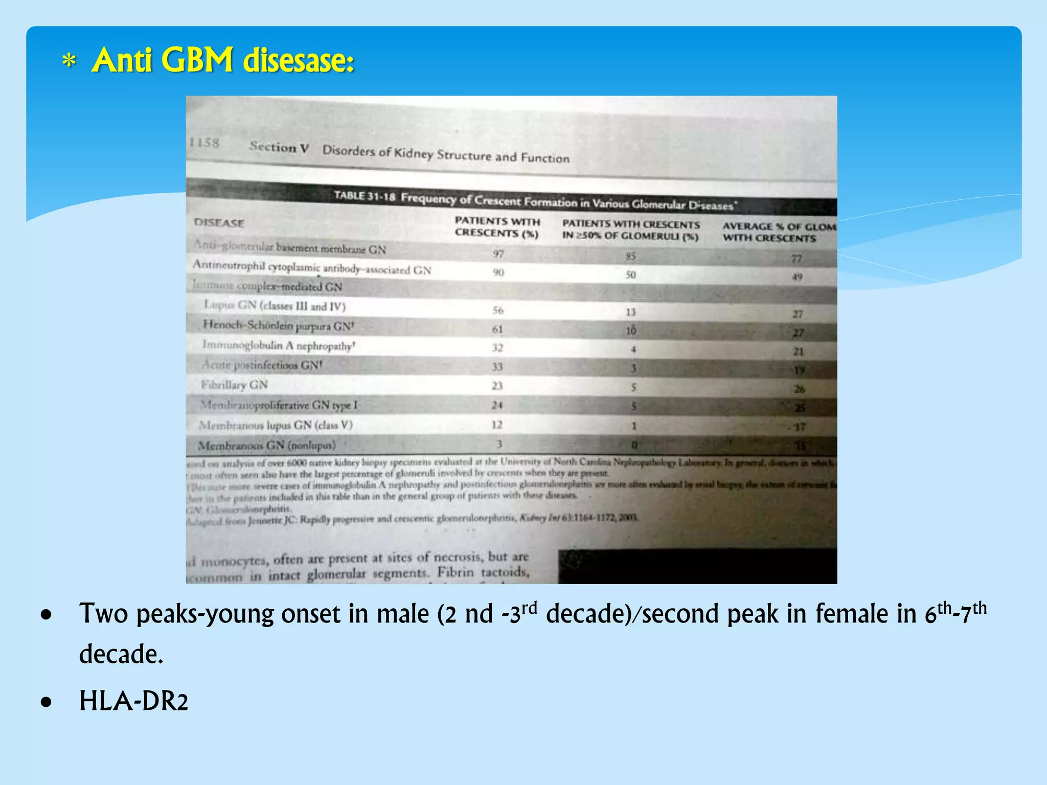  Anti GBM disesase:
 Two peaks-young onset in male (2 nd -3rd decade)/second peak in female in 6th-7th
decade.
 HLA-DR2
 