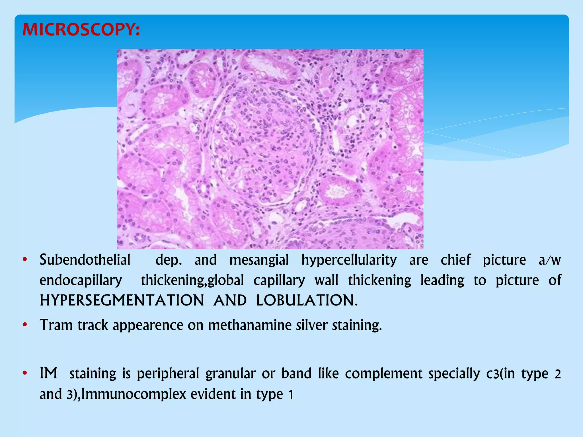 MICROSCOPY:
• Subendothelial dep. and mesangial hypercellularity are chief picture a/w
endocapillary thickening,global capillary wall thickening leading to picture of
HYPERSEGMENTATION AND LOBULATION.
• Tram track appearence on methanamine silver staining.
• IM staining is peripheral granular or band like complement specially c3(in type 2
and 3),Immunocomplex evident in type 1
 
