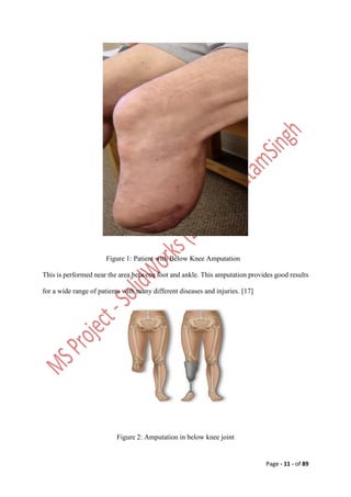 Design and Analysis of Affordable Artificial Knee Joint Model. Motion ...