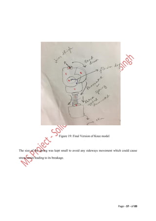 Design and Analysis of Affordable Artificial Knee Joint Model. Motion ...