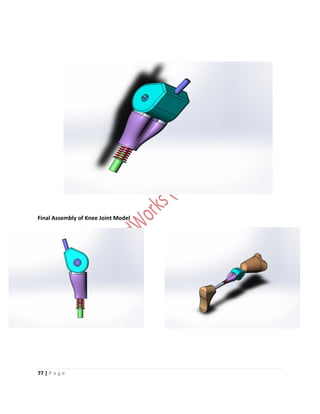 Design and Analysis of Affordable Artificial Knee Joint Model. Motion ...