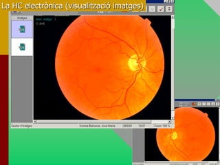 La HC electrònica (visualització imatges)
 